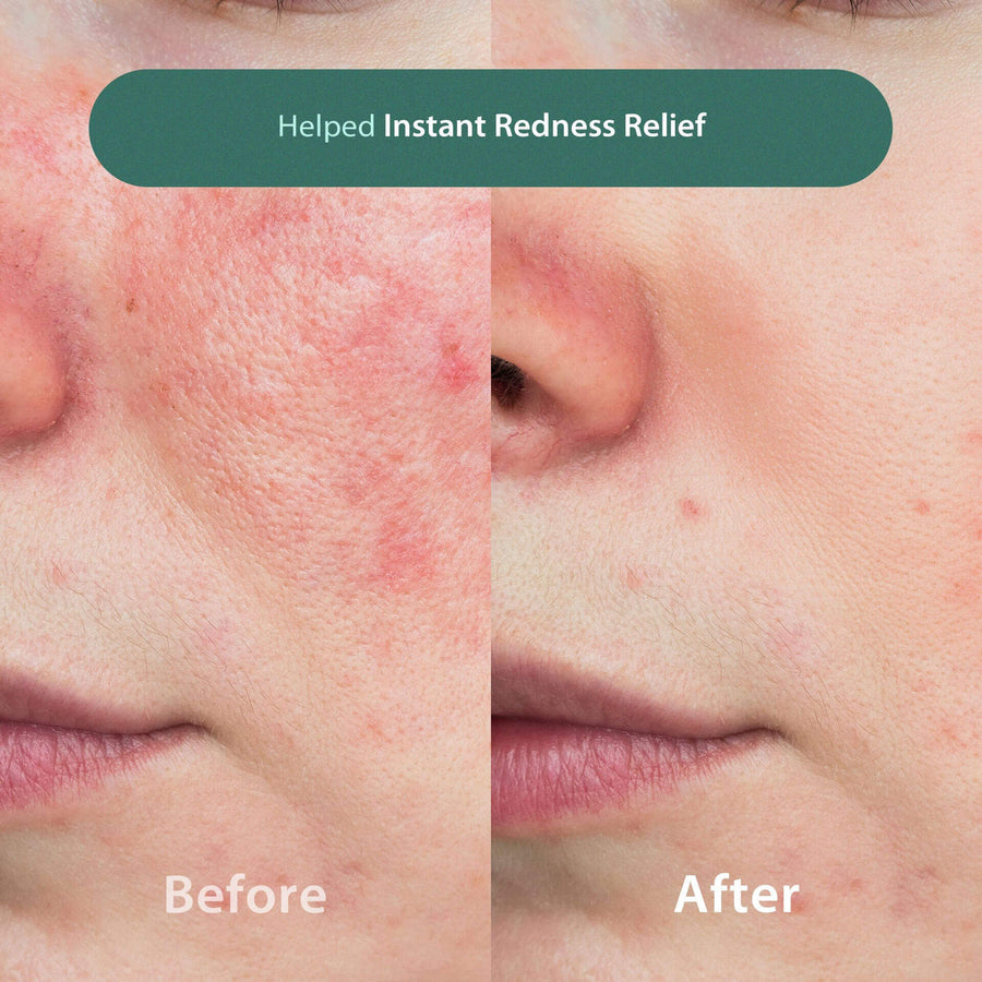 a before and after graphic providing redness relief