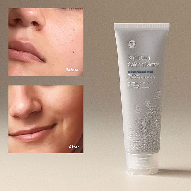 Bubbling Splash Mask before and after results for pore cleansing and sensitive skin